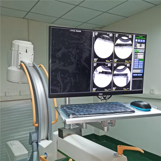 Radioscopie mobile chirurgicale C-Arm Xray C Arm X Ray Machine à vendre